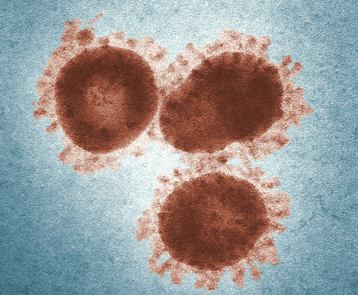 Wait, These Diseases Are Way Scarier Than You Think!