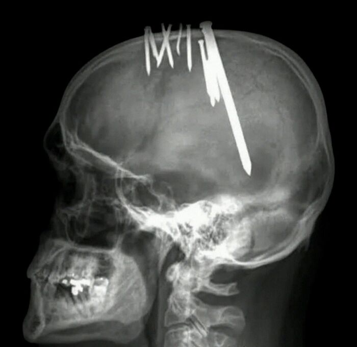 Wait, They Actually Took Pictures Of These Medical Weirdos?!