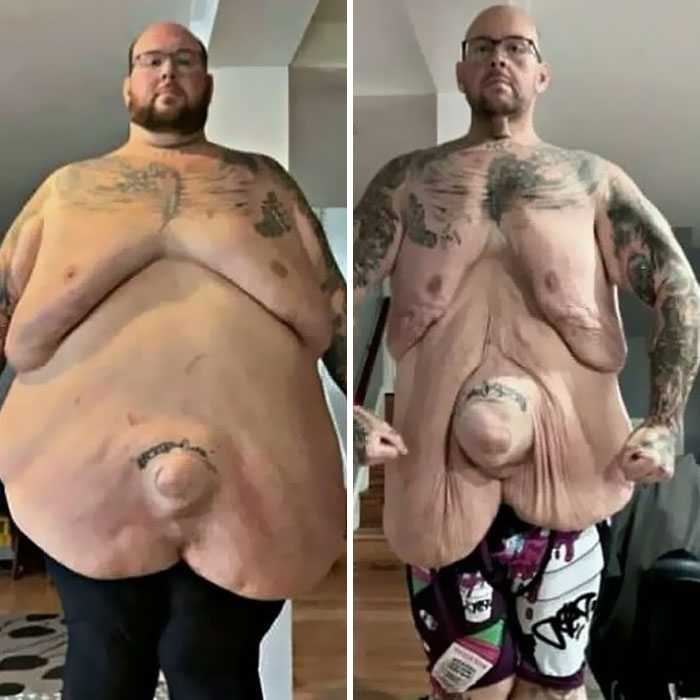 Wait, They Actually Took Pictures Of These Medical Weirdos?!