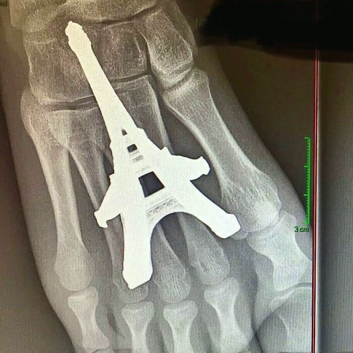 Wait, They Actually Took Pictures Of These Medical Weirdos?!