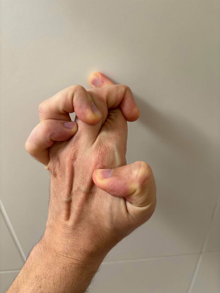 Hands That Bend Like Gumby