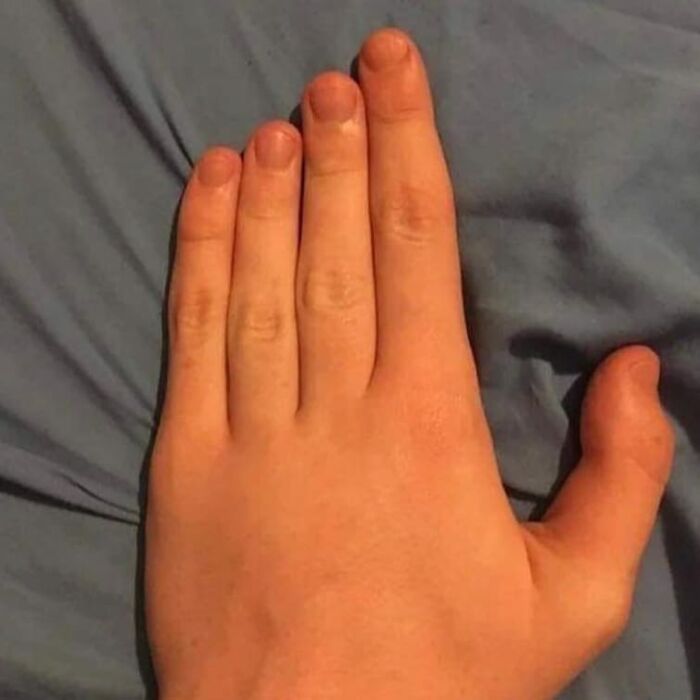 Wait, They Actually Collected These?? 99 Photos That Are So Weird You’ll Laugh and Groan
