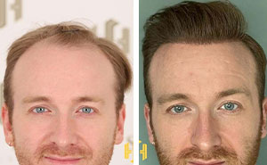81 Hair Makeovers That Totally Upgraded These Folks' Looks