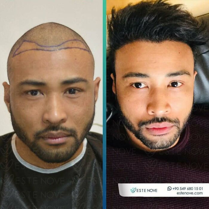 81 Hair Makeovers That Totally Upgraded These Folks' Looks