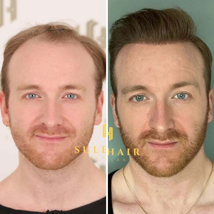 81 Hair Makeovers That Totally Upgraded These Folks' Looks