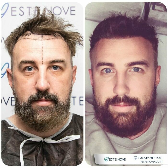 81 Hair Makeovers That Totally Upgraded These Folks' Looks