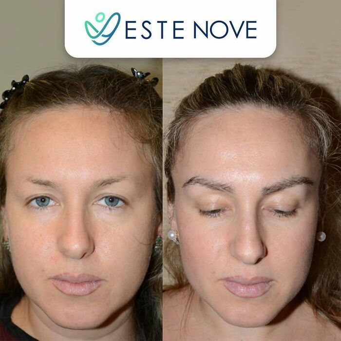 81 Hair Makeovers That Totally Upgraded These Folks' Looks