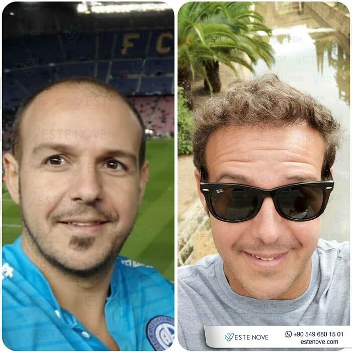 81 Hair Makeovers That Totally Upgraded These Folks' Looks