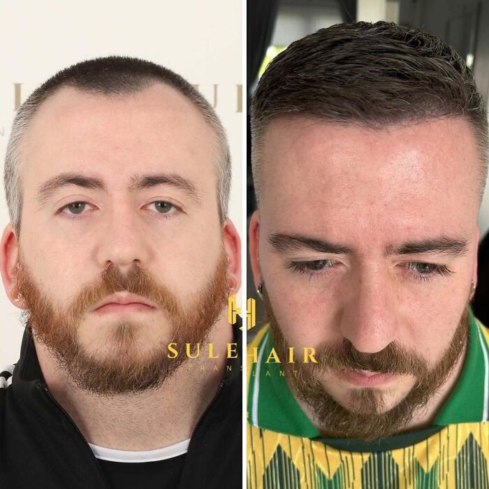 81 Hair Makeovers That Totally Upgraded These Folks' Looks