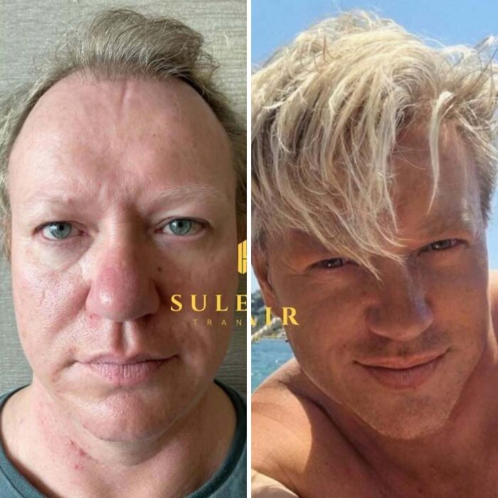 81 Hair Makeovers That Totally Upgraded These Folks' Looks