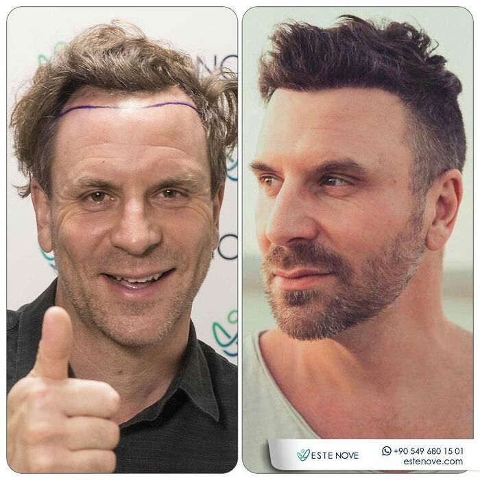 81 Hair Makeovers That Totally Upgraded These Folks' Looks