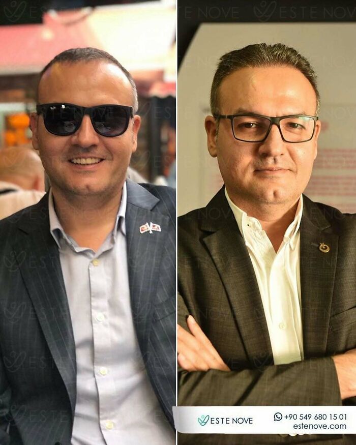 81 Hair Makeovers That Totally Upgraded These Folks' Looks