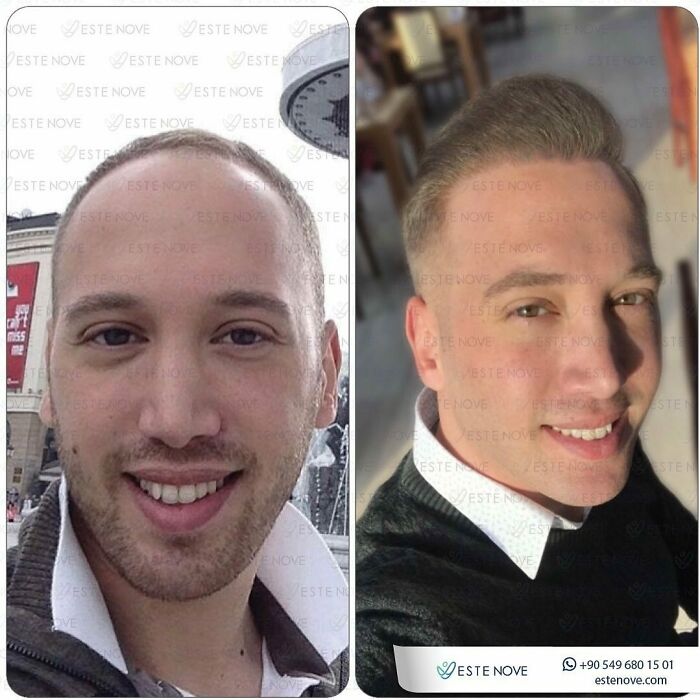 81 Hair Makeovers That Totally Upgraded These Folks' Looks