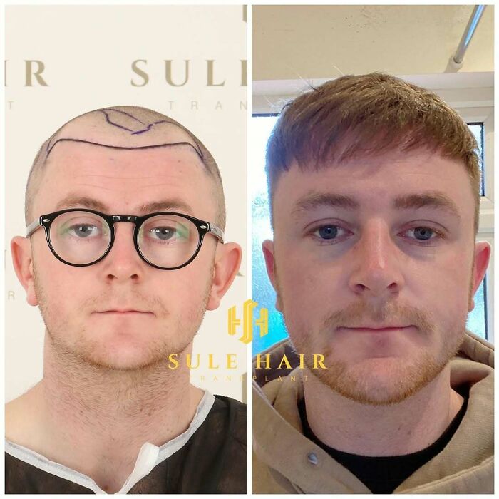 81 Hair Makeovers That Totally Upgraded These Folks' Looks