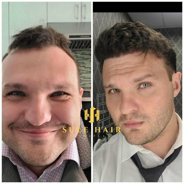 81 Hair Makeovers That Totally Upgraded These Folks' Looks