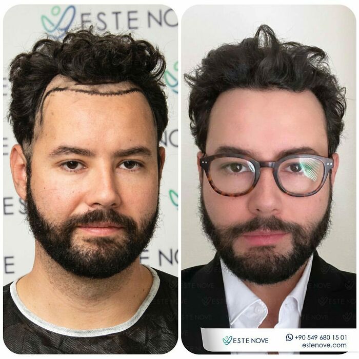 81 Hair Makeovers That Totally Upgraded These Folks' Looks