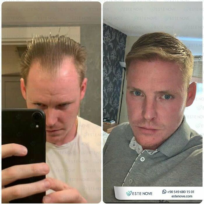 81 Hair Makeovers That Totally Upgraded These Folks' Looks