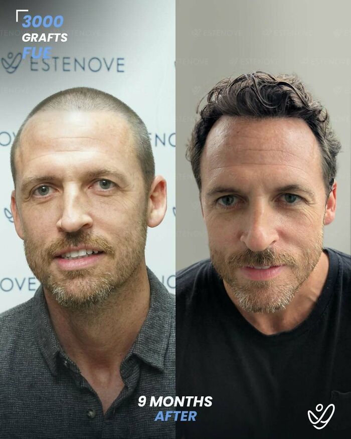 81 Hair Makeovers That Totally Upgraded These Folks' Looks