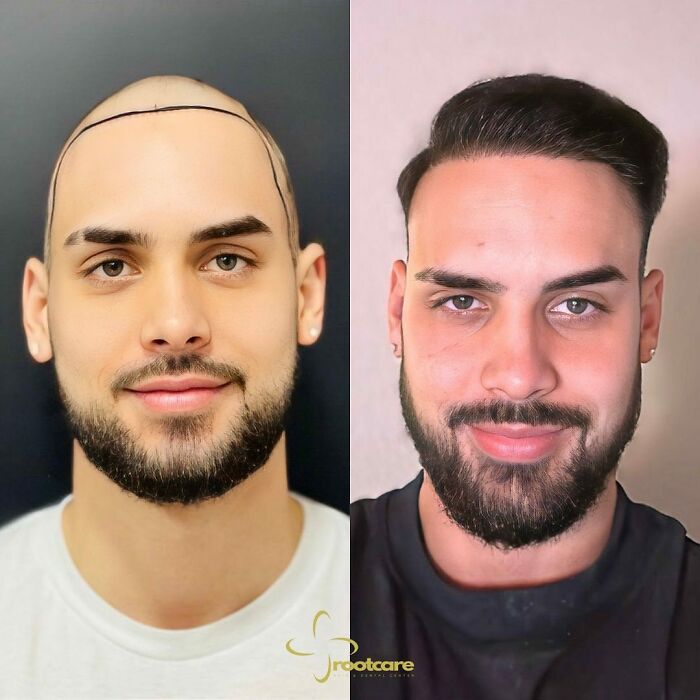 81 Hair Makeovers That Totally Upgraded These Folks' Looks