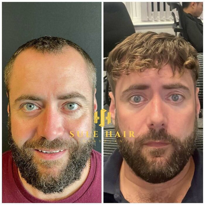 81 Hair Makeovers That Totally Upgraded These Folks' Looks