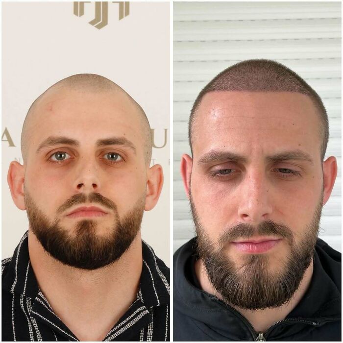 81 Hair Makeovers That Totally Upgraded These Folks' Looks