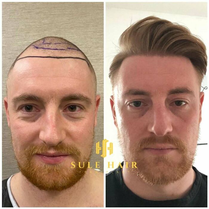 81 Hair Makeovers That Totally Upgraded These Folks' Looks