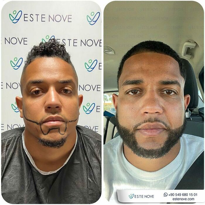 81 Hair Makeovers That Totally Upgraded These Folks' Looks