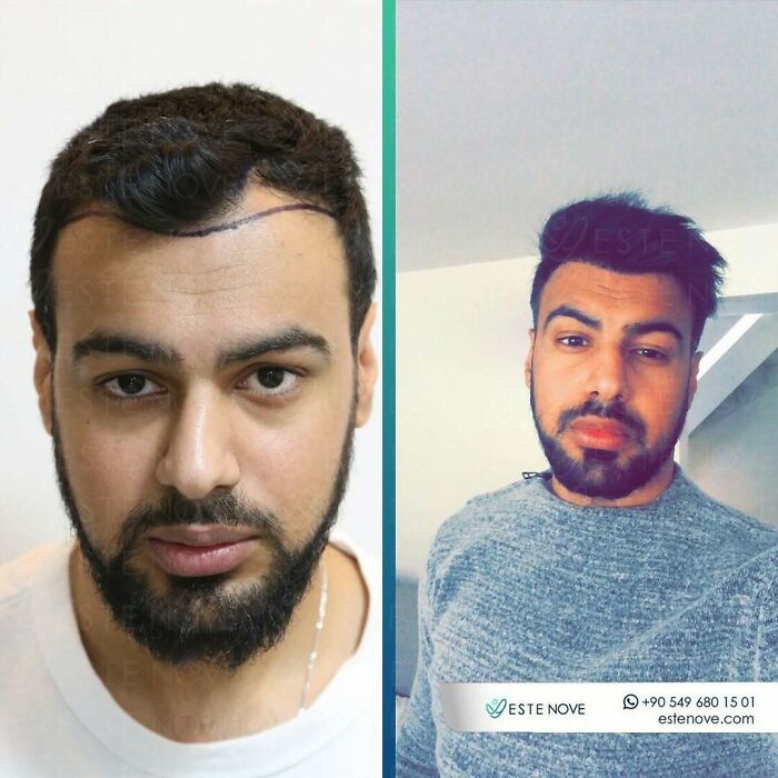 81 Hair Makeovers That Totally Upgraded These Folks' Looks