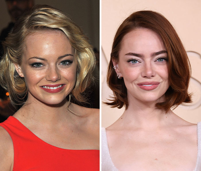 Emma Stone’s Face Glow-Up (Or What Even Happened?)