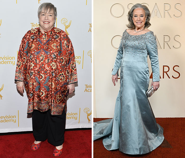 Kathy Bates and That Jaw-Dropping Weight Loss