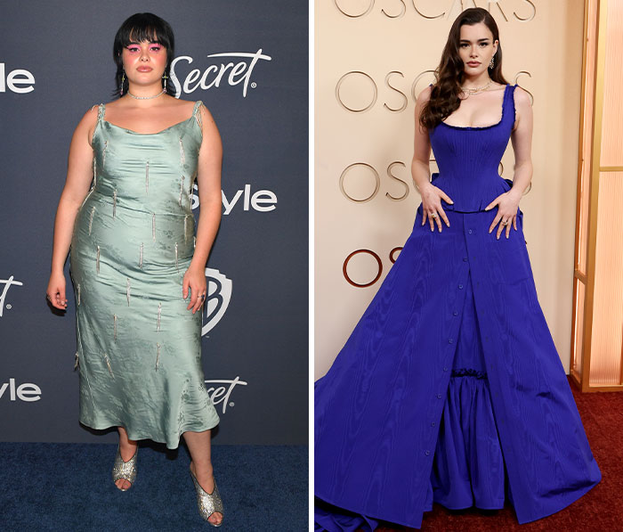Barbie Ferreira’s Big Weight Loss Reveal