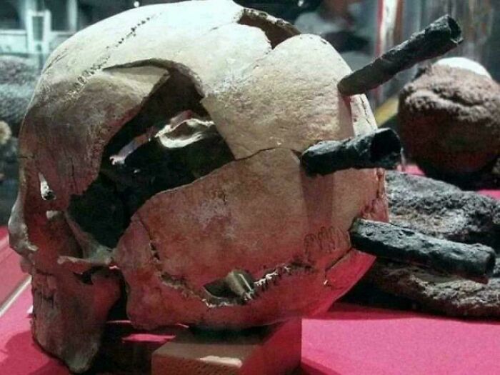 Arrowheads Found in a Man’s Skull From a 1361 Battle in Sweden—Ouch, That’s Gotta Hurt!