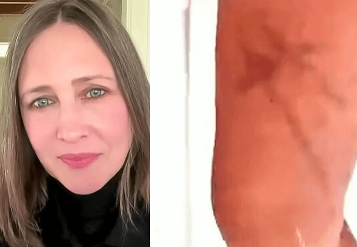 Vera Farmiga Got Cross-Shaped Mysterious Bruises During Filming of The Conjuring: Last Rites. Spooky Much?