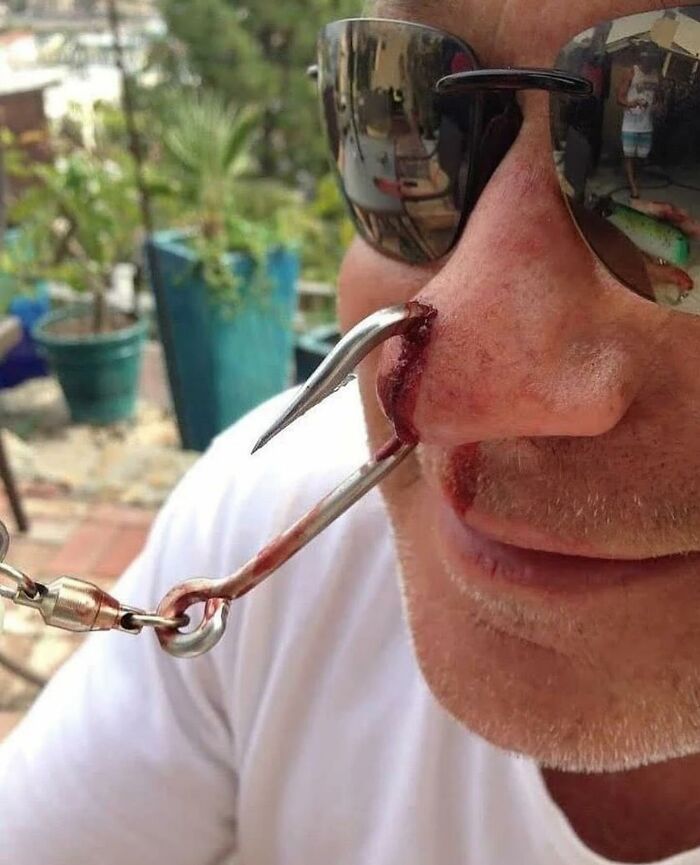 Fish Hook: When Bait Catches You Instead!