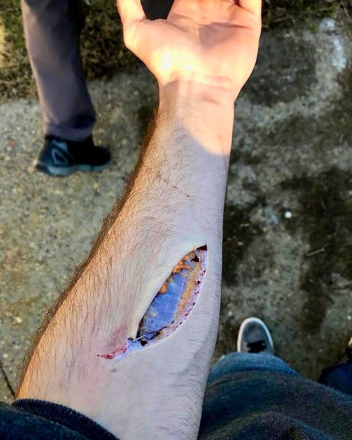 Fascia: The Body’s Sneaky White Web Under Your Skin