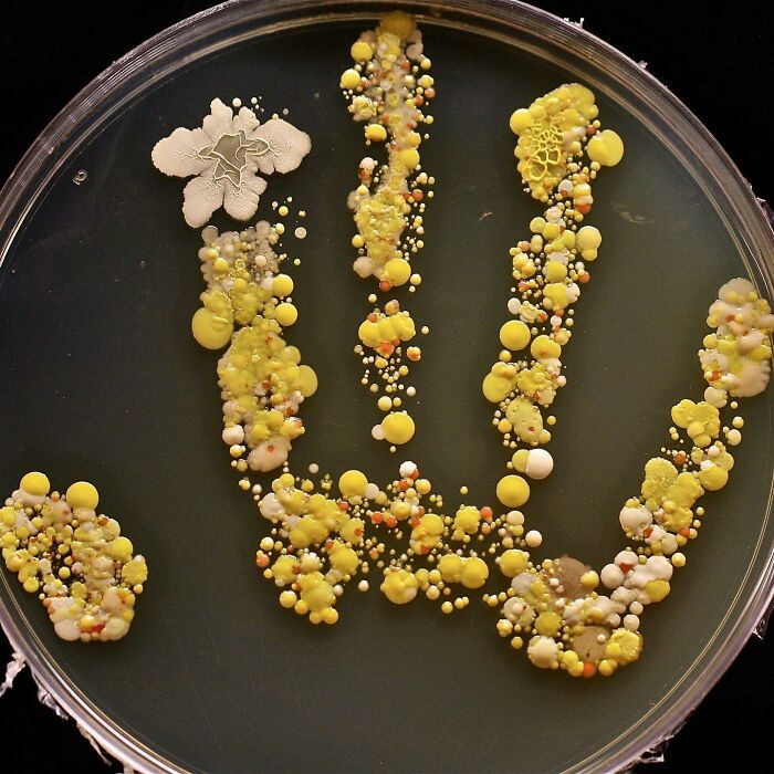 8-Year-Old’s Handprint Is Bacteria’s Favorite Buffet