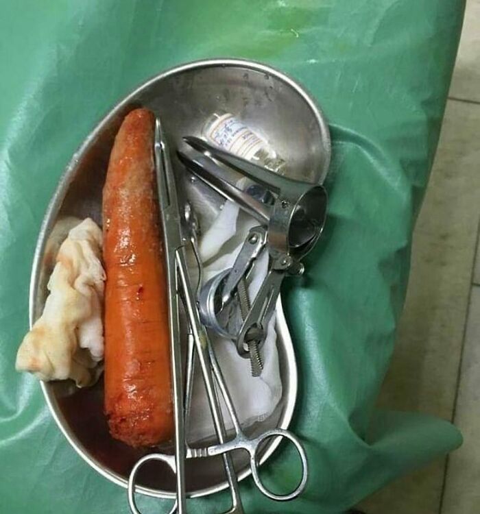 Gross but Cool: Weird Medical Thing Pulled Out Whole