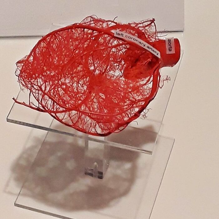 A Mesh of Blood Vessels Feeding the Human Heart