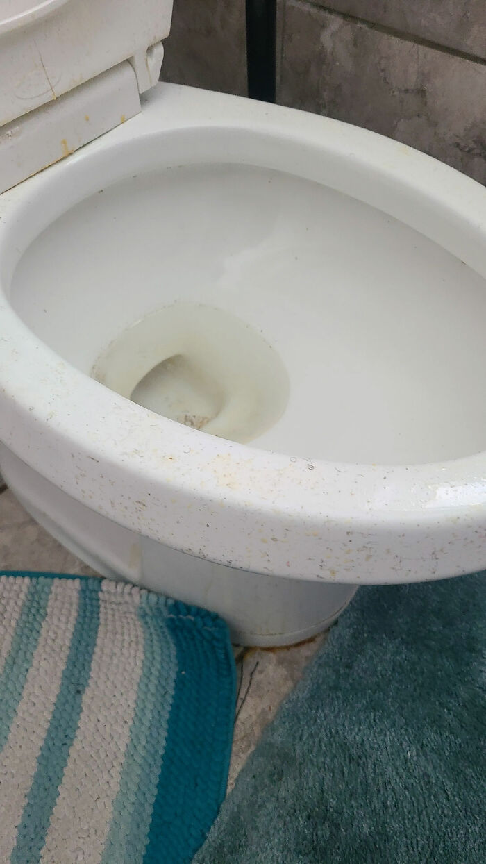 The Moldy Throne: When Hygiene and Allergy Clash