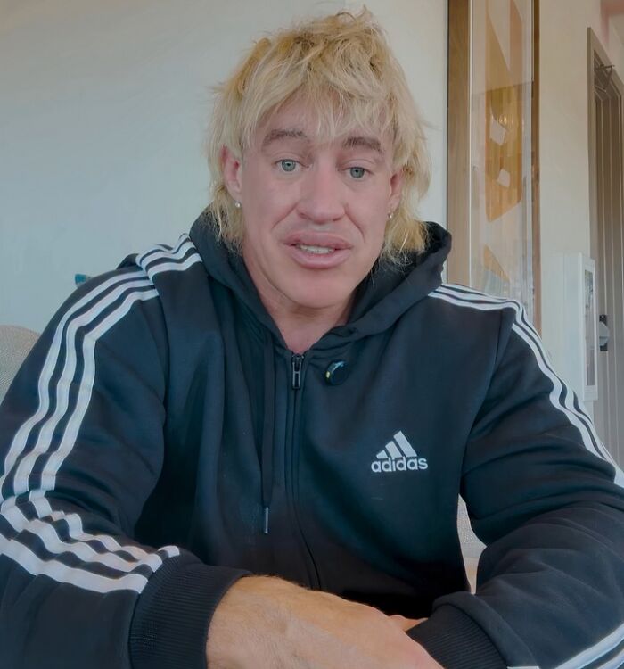 Fitness Influencer Admits Fibbing About War Injury