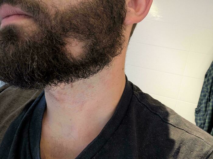 My Beard Fell Out In A Perfect Circle. Spooky!