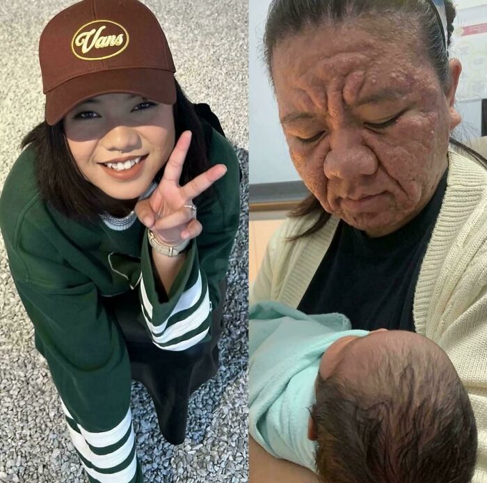 28-Year-Old Mom’s Face Took A Wrinkly Turn During Pregnancy!