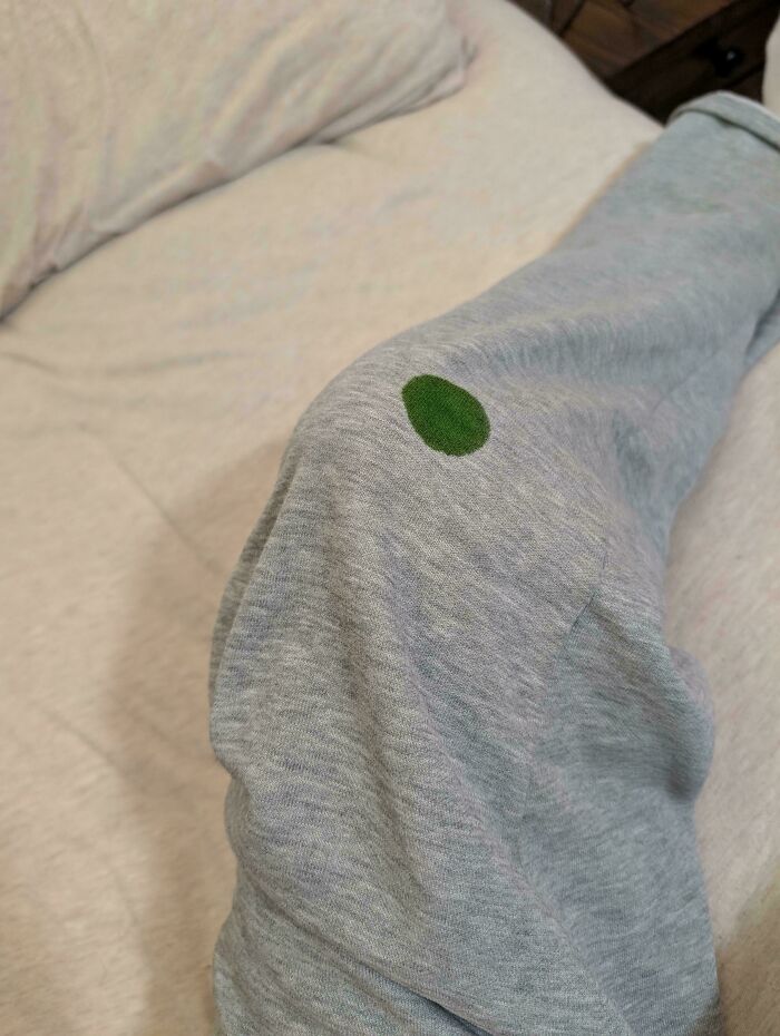 Woke Up With This Weird Green Stain ... Just On My Pants!