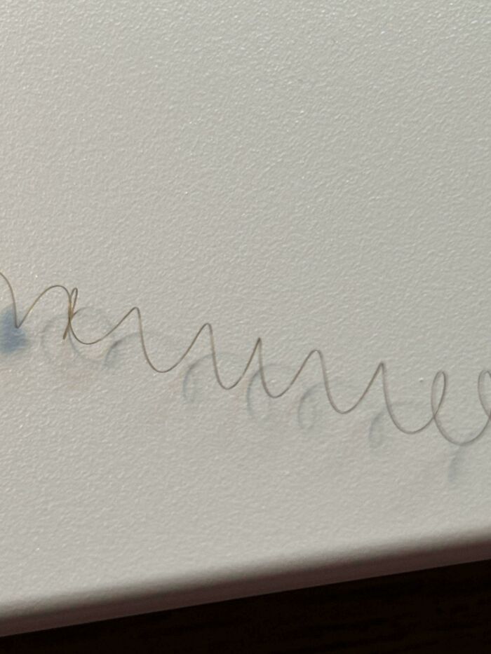 Weird Hairs Keep Showing Up On My Scalp. What’s Going On?