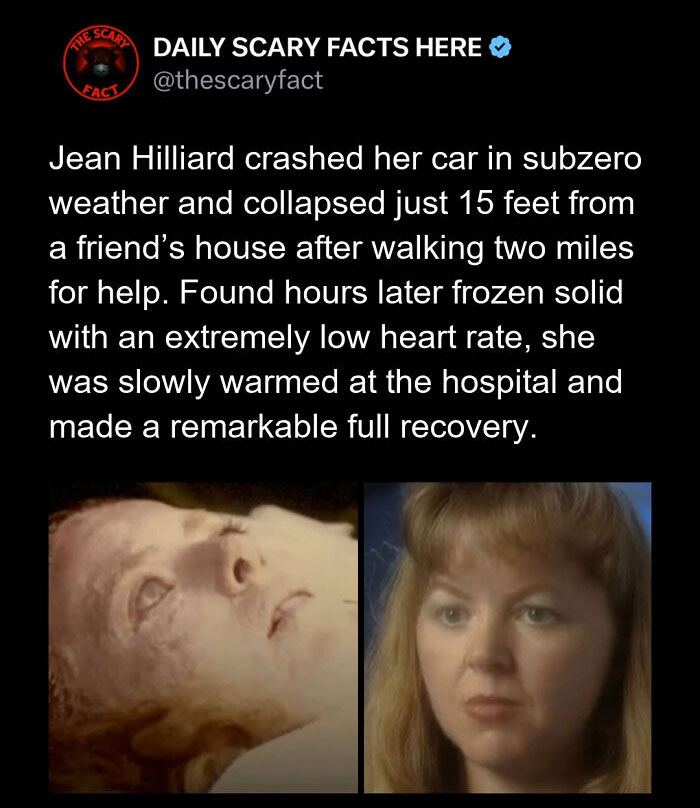 Hold Up—83 Shocking Real-Life Stories That'll Totally Blow Your Mind