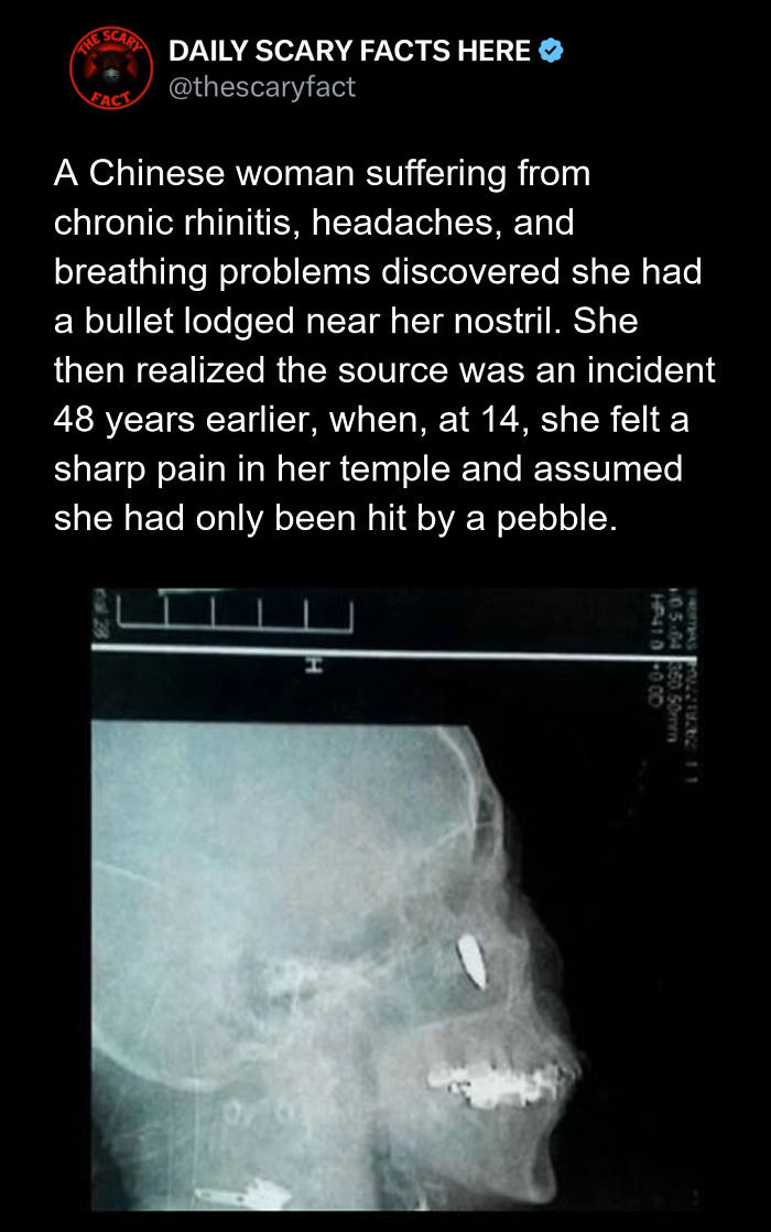 Hold Up—83 Shocking Real-Life Stories That'll Totally Blow Your Mind