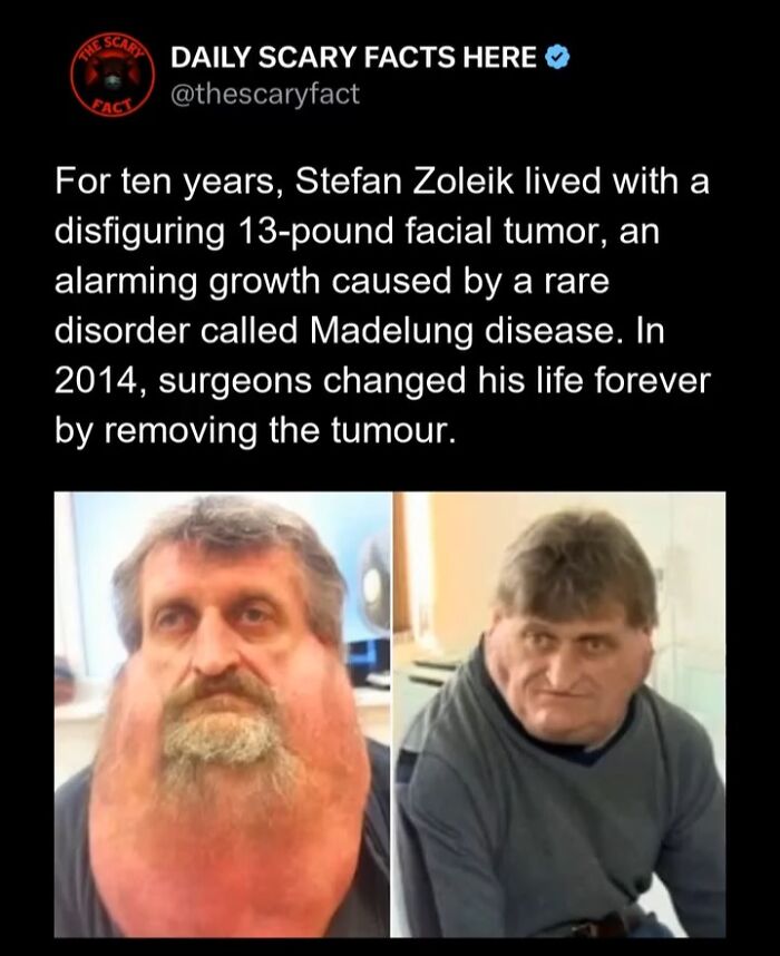 Hold Up—83 Shocking Real-Life Stories That'll Totally Blow Your Mind