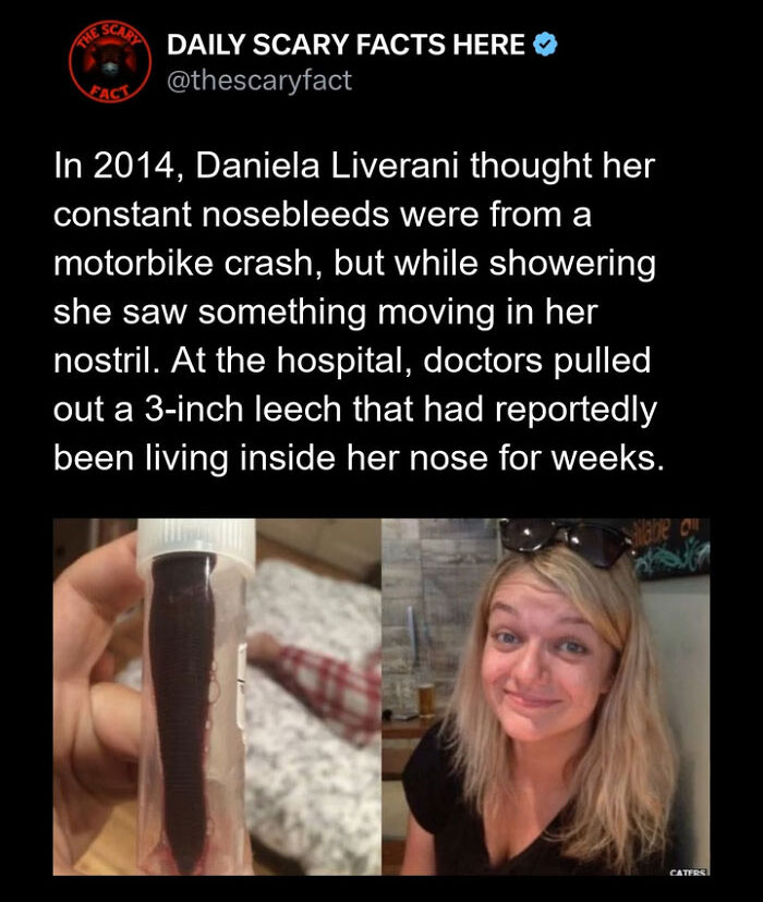 Hold Up—83 Shocking Real-Life Stories That'll Totally Blow Your Mind