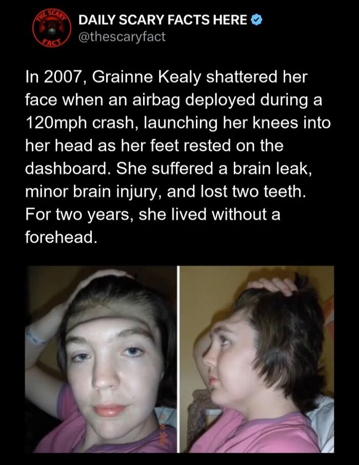 Hold Up—83 Shocking Real-Life Stories That'll Totally Blow Your Mind