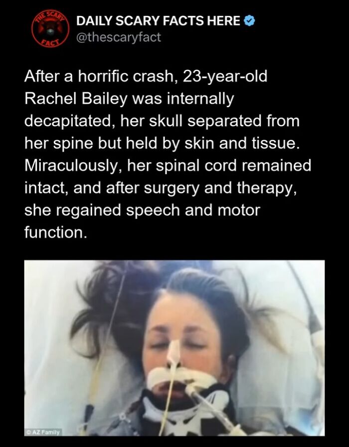 Hold Up—83 Shocking Real-Life Stories That'll Totally Blow Your Mind